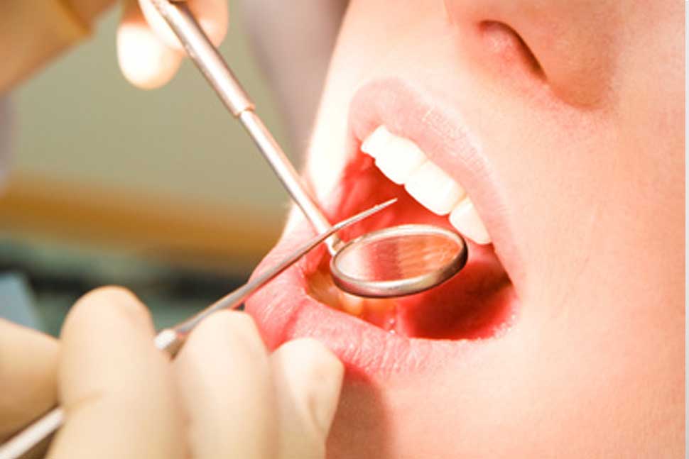 予防/歯のメンテナンス